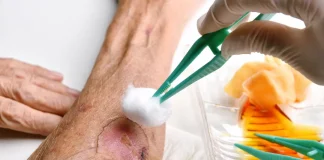 arginine in wound healing.